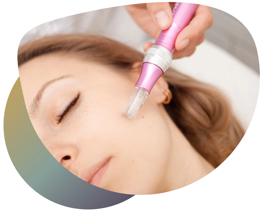 A person undergoing SHR laser hair removal treatment on their neck, with a pink hair remover device in use.